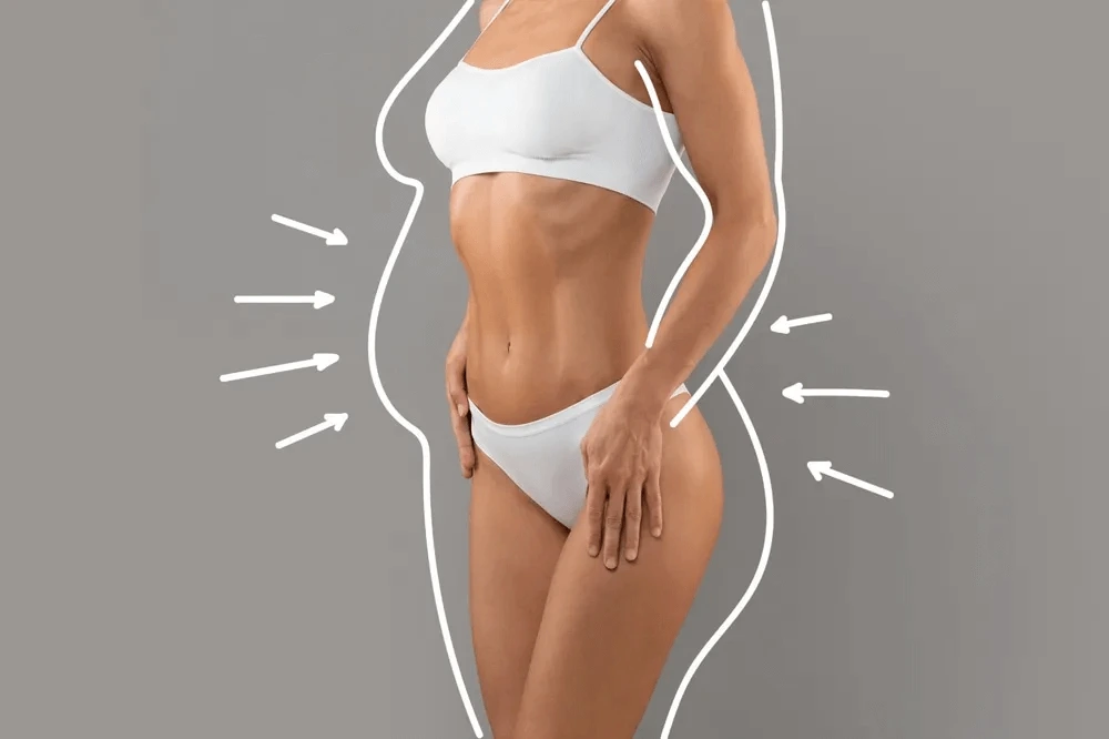 Imagem Exemplo de Lipoescultura
